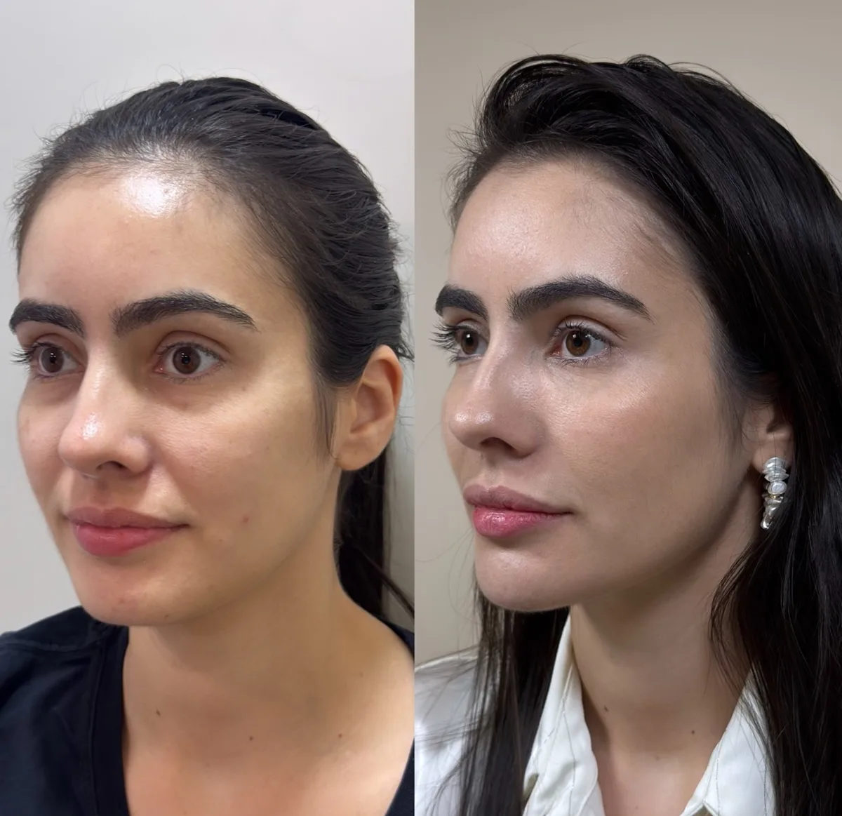Full face